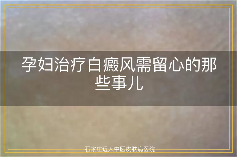 孕妇治疗白癜风需留心的那些事儿