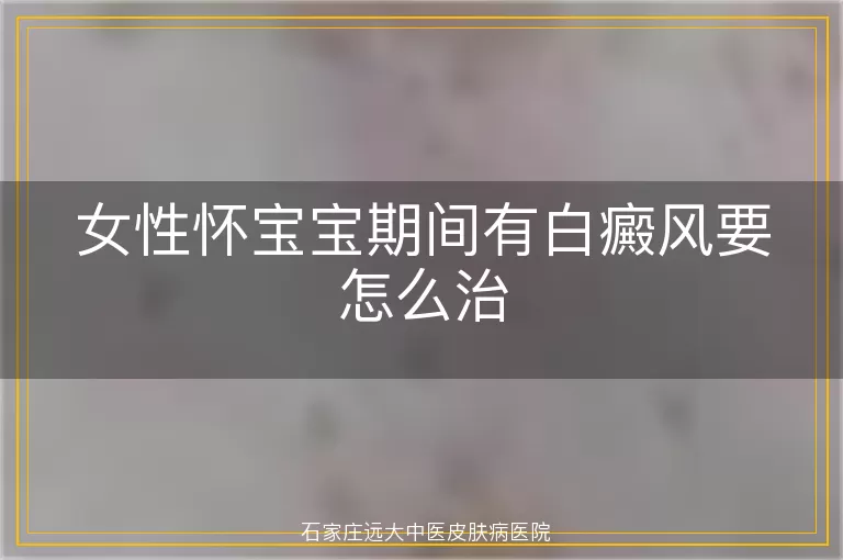 女性怀宝宝期间有白癜风要怎么治