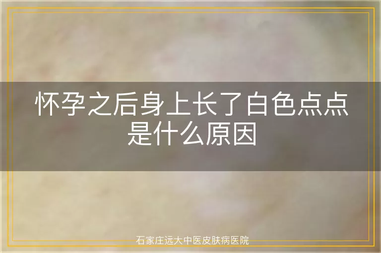 怀孕之后身上长了白色点点是什么原因
