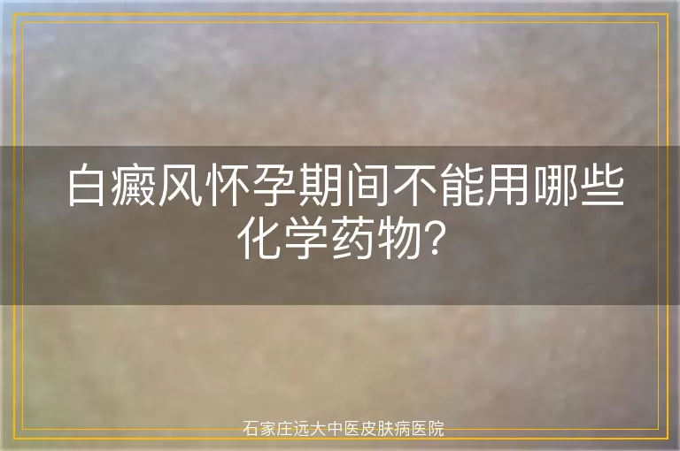 白癜风怀孕期间不能用哪些化学药物?