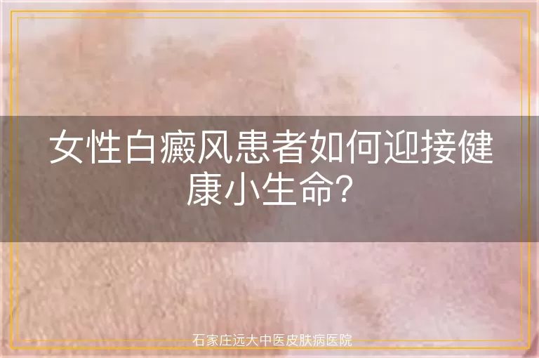 女性白癜风患者如何迎接健康小生命？