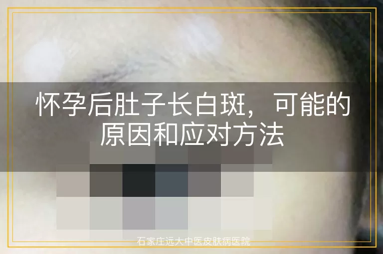 怀孕后肚子长白斑,可能的原因和应对方法