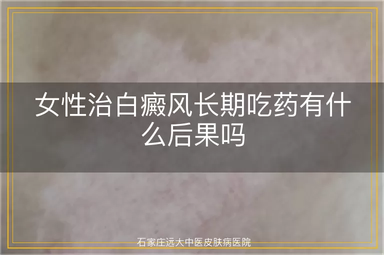 女性治白癜风长期吃药有什么后果吗
