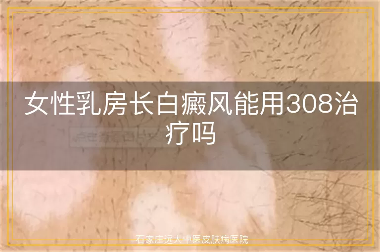 女性乳房长白癜风能用308治疗吗