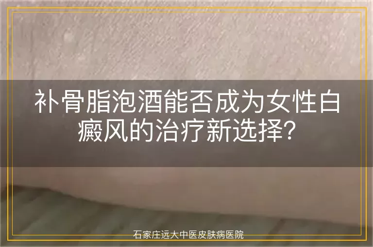 补骨脂泡酒能否成为女性白癜风的治疗新选择？