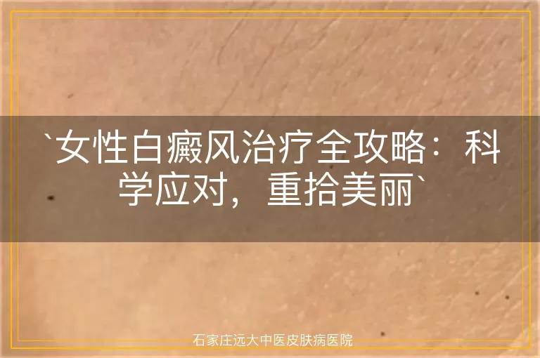 女性白癜风治疗全攻略：科学应对，重拾美丽
