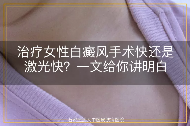 治疗女性白癜风手术快还是激光快？一文给你讲明白