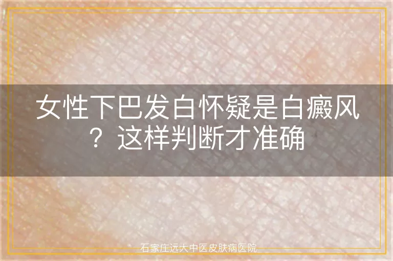 女性下巴发白怀疑是白癜风？这样判断才准确