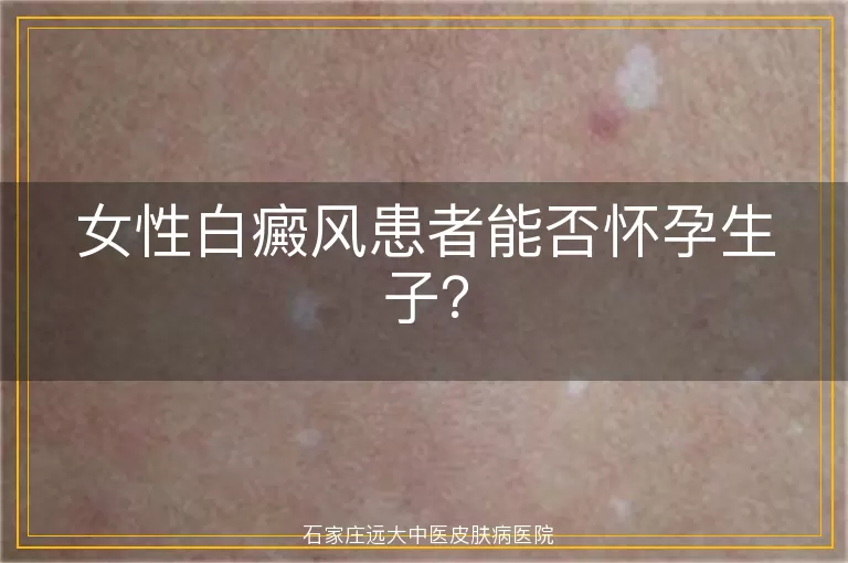 女性白癜风患者能否怀孕生子？
