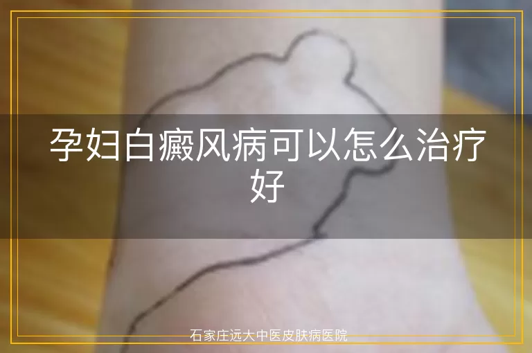 孕妇白癜风病可以怎么治疗好