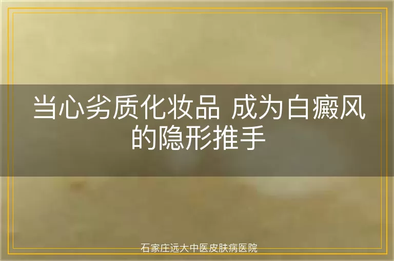 当心劣质化妆品 成为白癜风的隐形推手