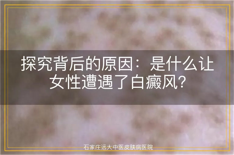 探究背后的原因：是什么让女性遭遇了白癜风？