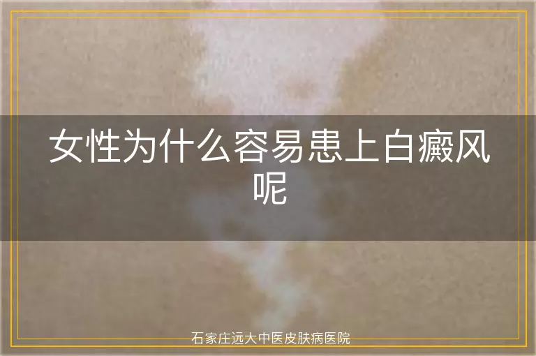 女性为什么容易患上白癜风呢