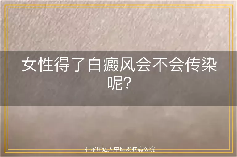 女性得了白癜风会不会传染呢？