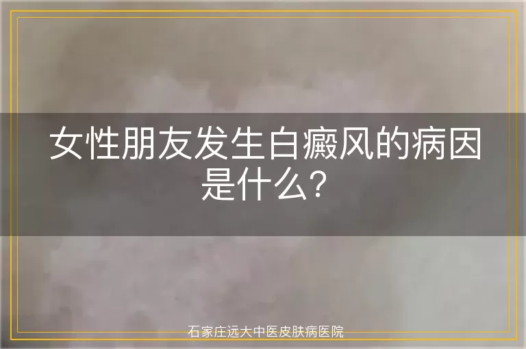 女性朋友发生白癜风的病因是什么？