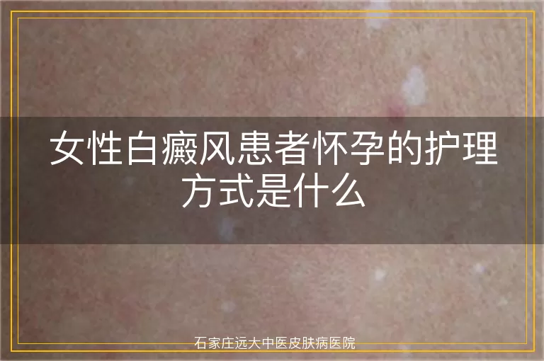女性白癜风患者怀孕的护理方式是什么