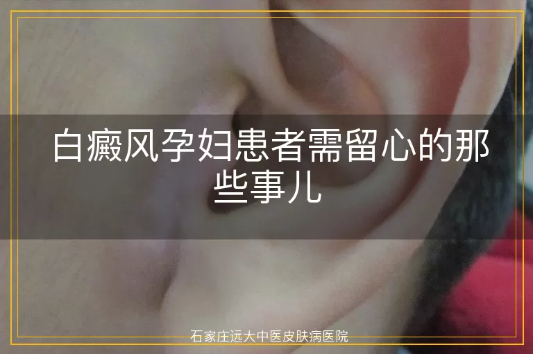 白癜风孕妇患者需留心的那些事儿