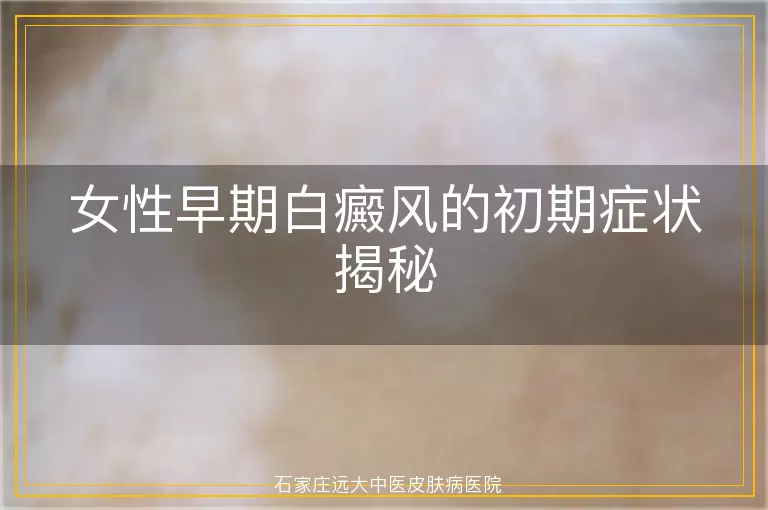 女性早期白癜风的初期症状揭秘
