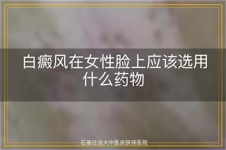 白癜风在女性脸上应该选用什么药物