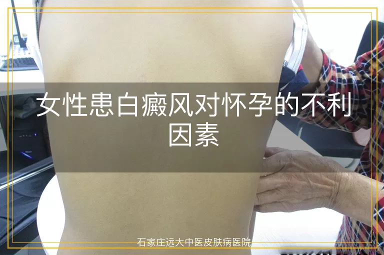 女性患白癜风对怀孕的不利因素