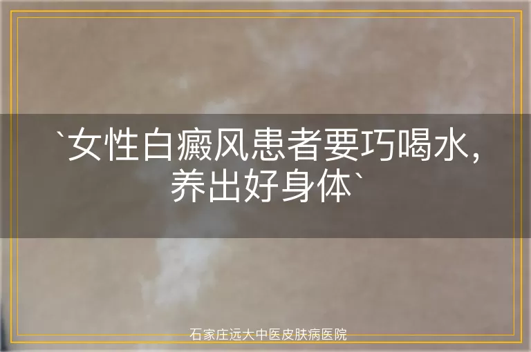 女性白癜风患者要巧喝水，养出好身体