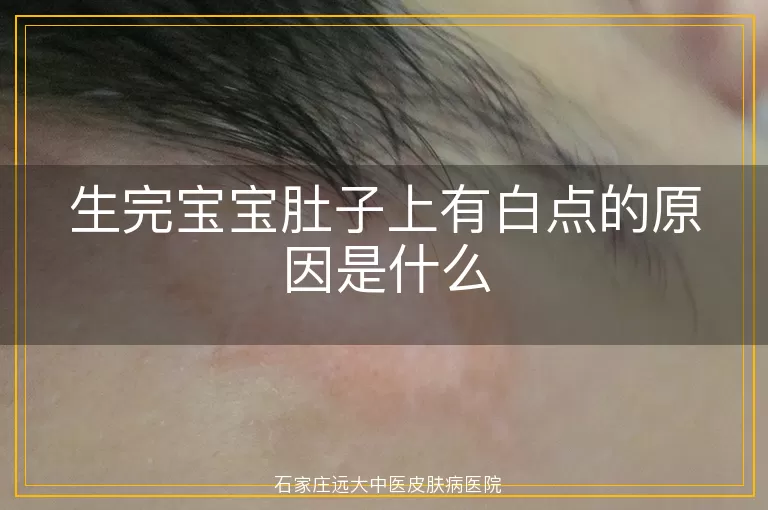 生完宝宝肚子上有白点的原因是什么