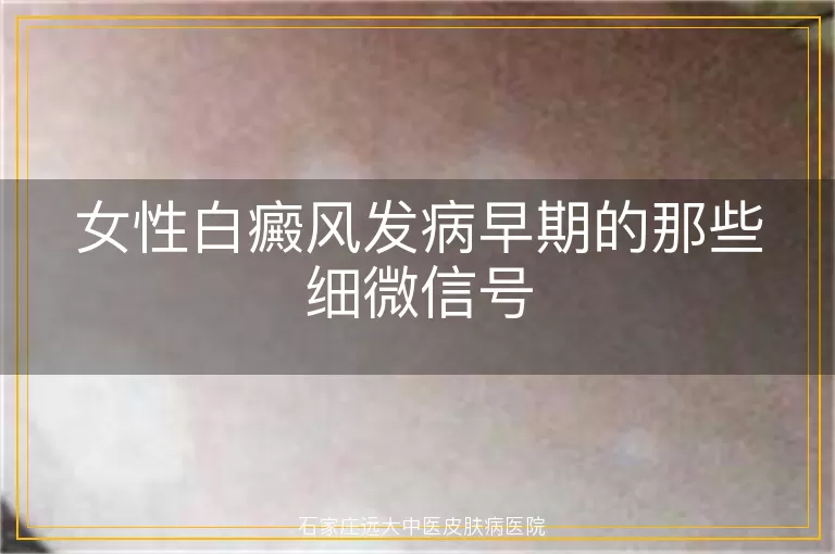 女性白癜风发病早期的那些细微信号