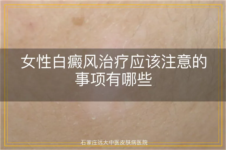 女性白癜风治疗应该注意的事项有哪些