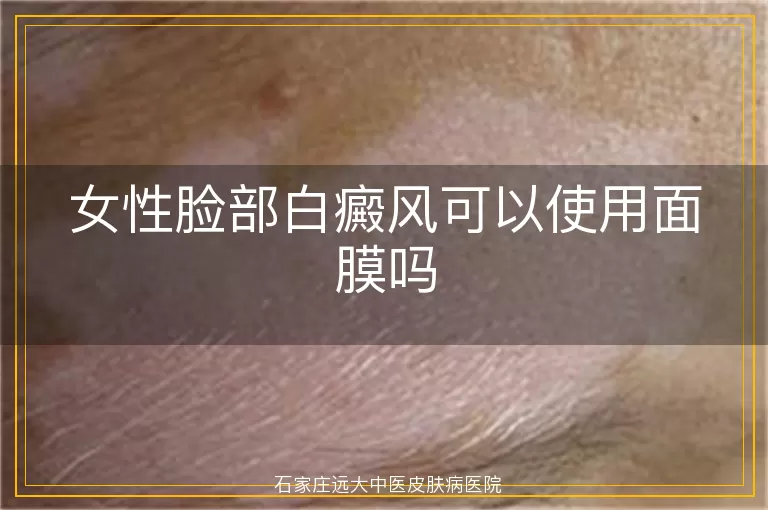 女性脸部白癜风可以使用面膜吗