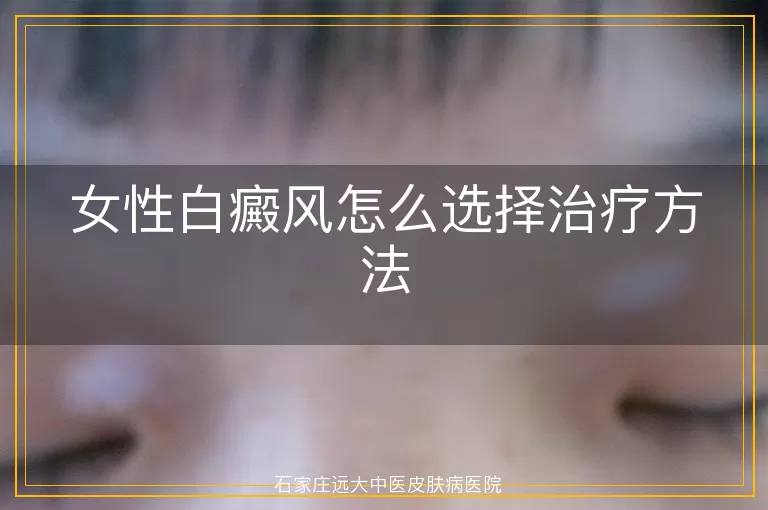 女性白癜风怎么选择治疗方法