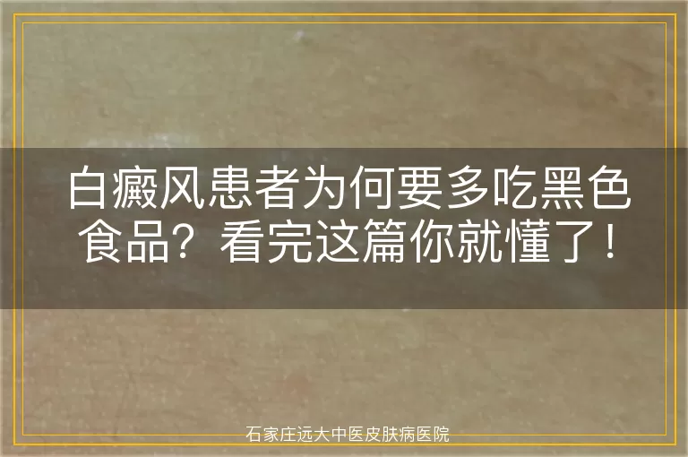白癜风患者为何要多吃黑色食品？看完这篇你就懂了！