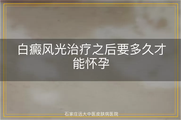 白癜风光治疗之后要多久才能怀孕