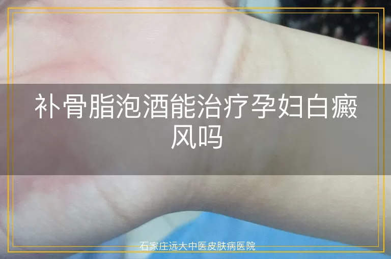 补骨脂泡酒能治疗孕妇白癜风吗