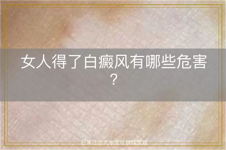 女人得了白癜风有哪些危害?