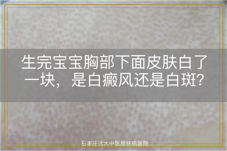 生完宝宝胸部下面皮肤白了一块，是白癜风还是白斑？