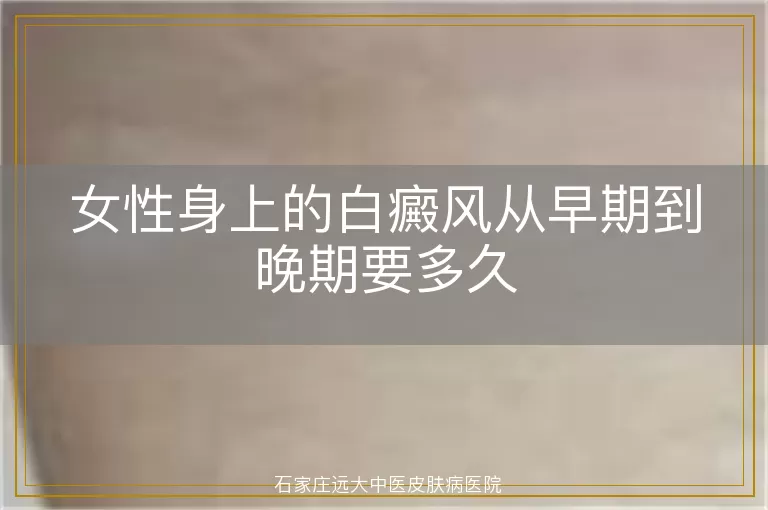 女性身上的白癜风从早期到晚期要多久