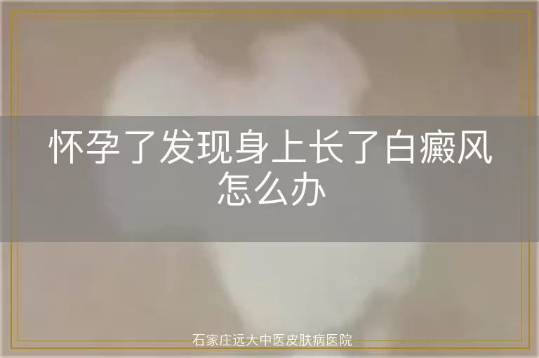 怀孕了发现身上长了白癜风怎么办
