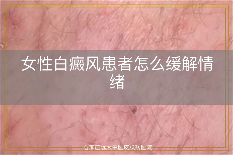 女性白癜风患者怎么缓解情绪