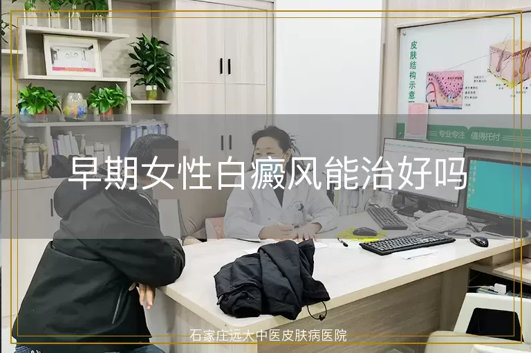 早期女性白癜风能治好吗