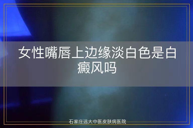 女性嘴唇上边缘淡白色是白癜风吗