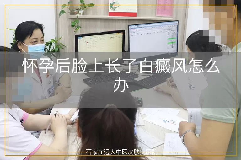 怀孕后脸上长了白癜风怎么办
