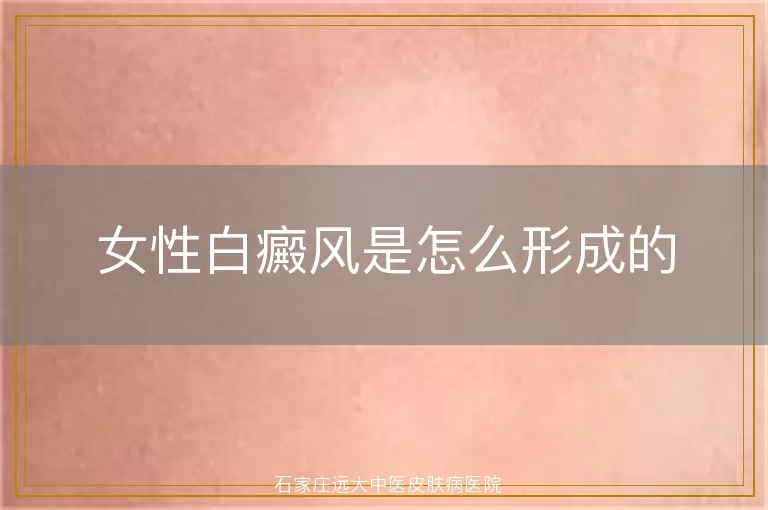 女性白癜风是怎么形成的