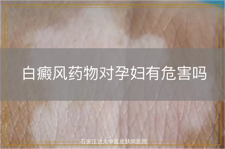 白癜风药物对孕妇有危害吗