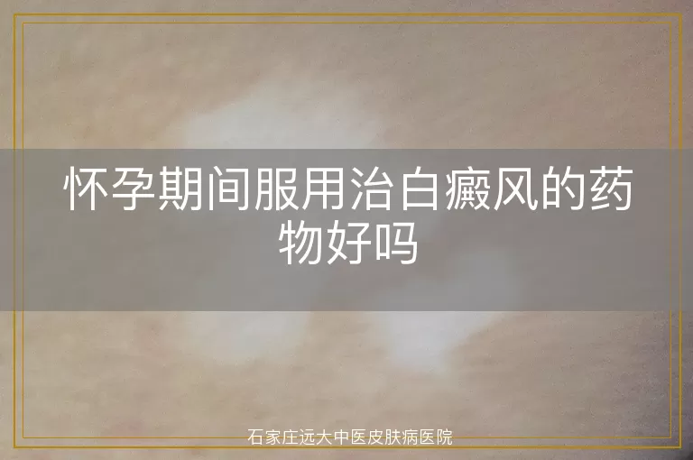 怀孕期间服用治白癜风的药物好吗