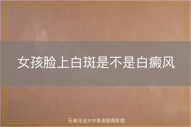 女孩脸上白斑是不是白癜风