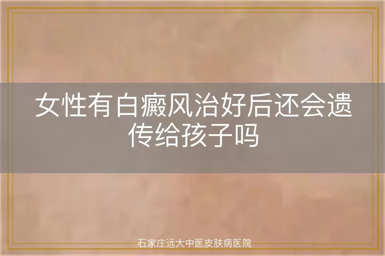 女性有白癜风治好后还会遗传给孩子吗