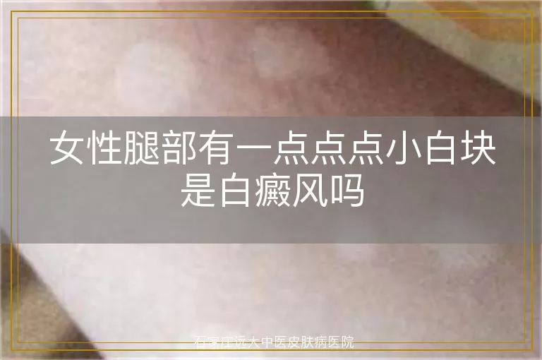 女性腿部有一点点点小白块是白癜风吗