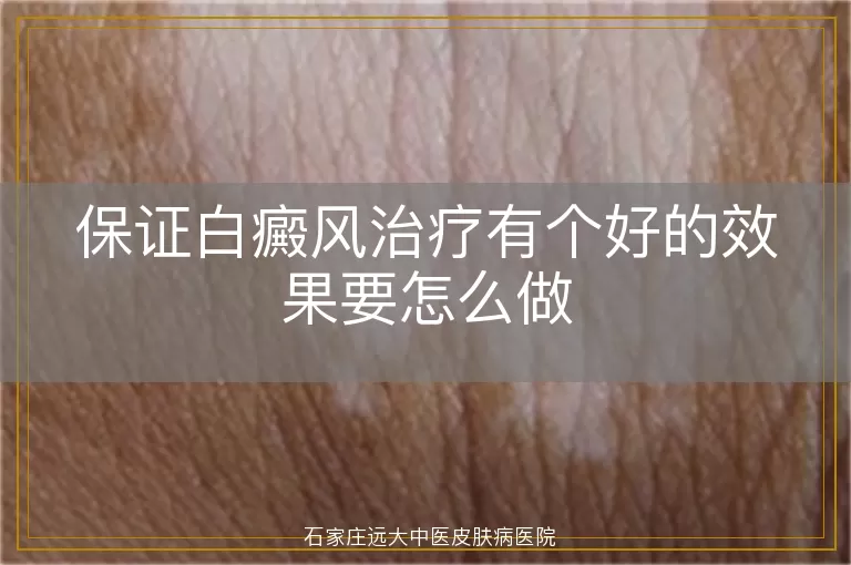 保证白癜风治疗有个好的效果要怎么做