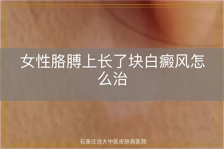 女性胳膊上长了块白癜风怎么治