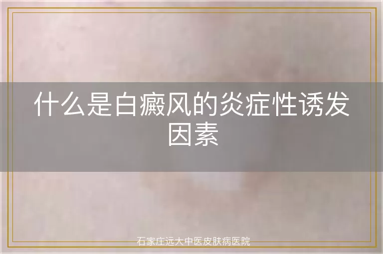 什么是白癜风的炎症性诱发因素